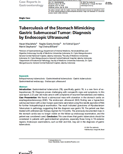 Tuberculosis_of_the_Stomach_Mimicking